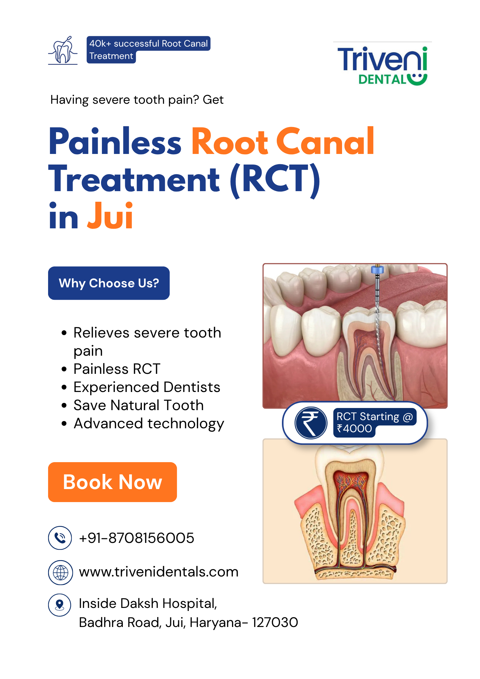  Root Canal Treatment (RCT) in Jui | Triveni Dental