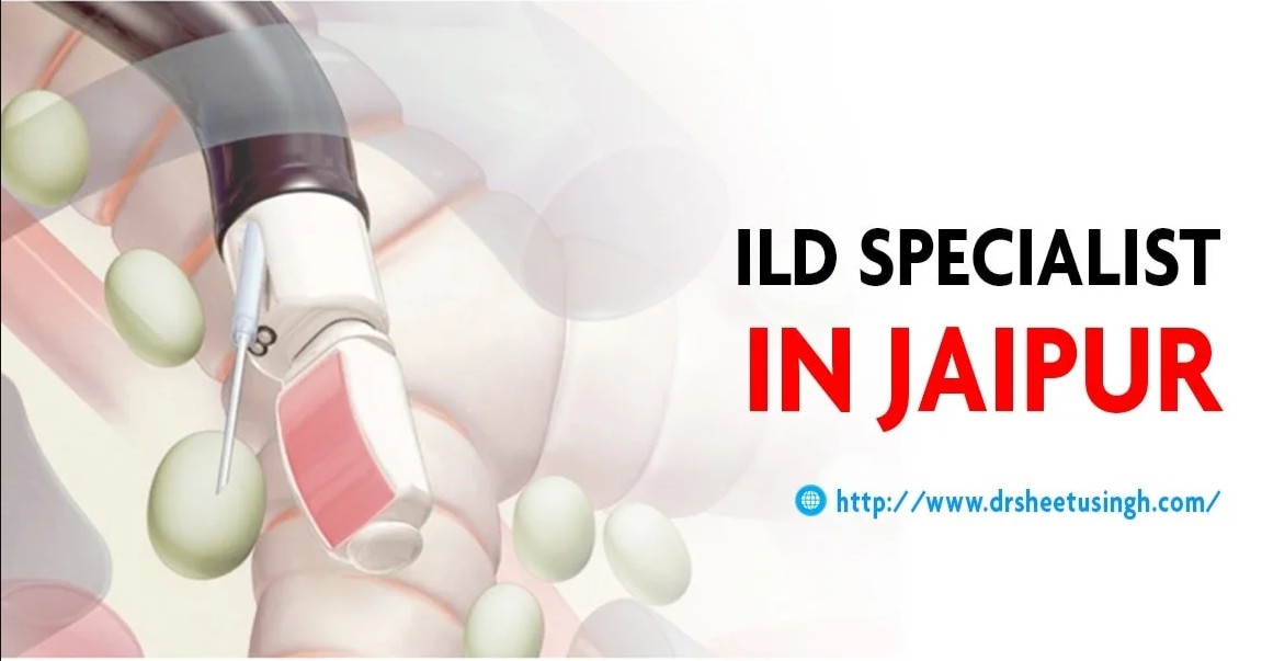  Specialized Interstitial Lung Disease Care in Jaipur, Rajasthan – Dr. Sheetu Singh