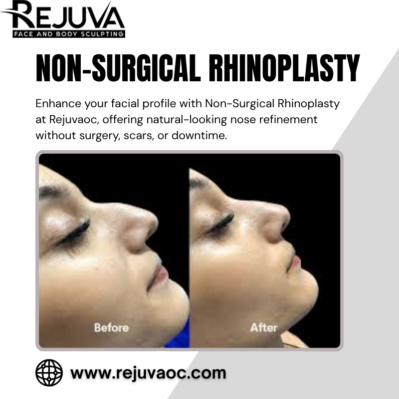  What to Consider Before Non-Surgical Rhinoplasty in Newport Beach