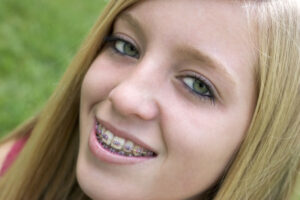  Dental Implants Treatment in Los Angeles & Inglewood
