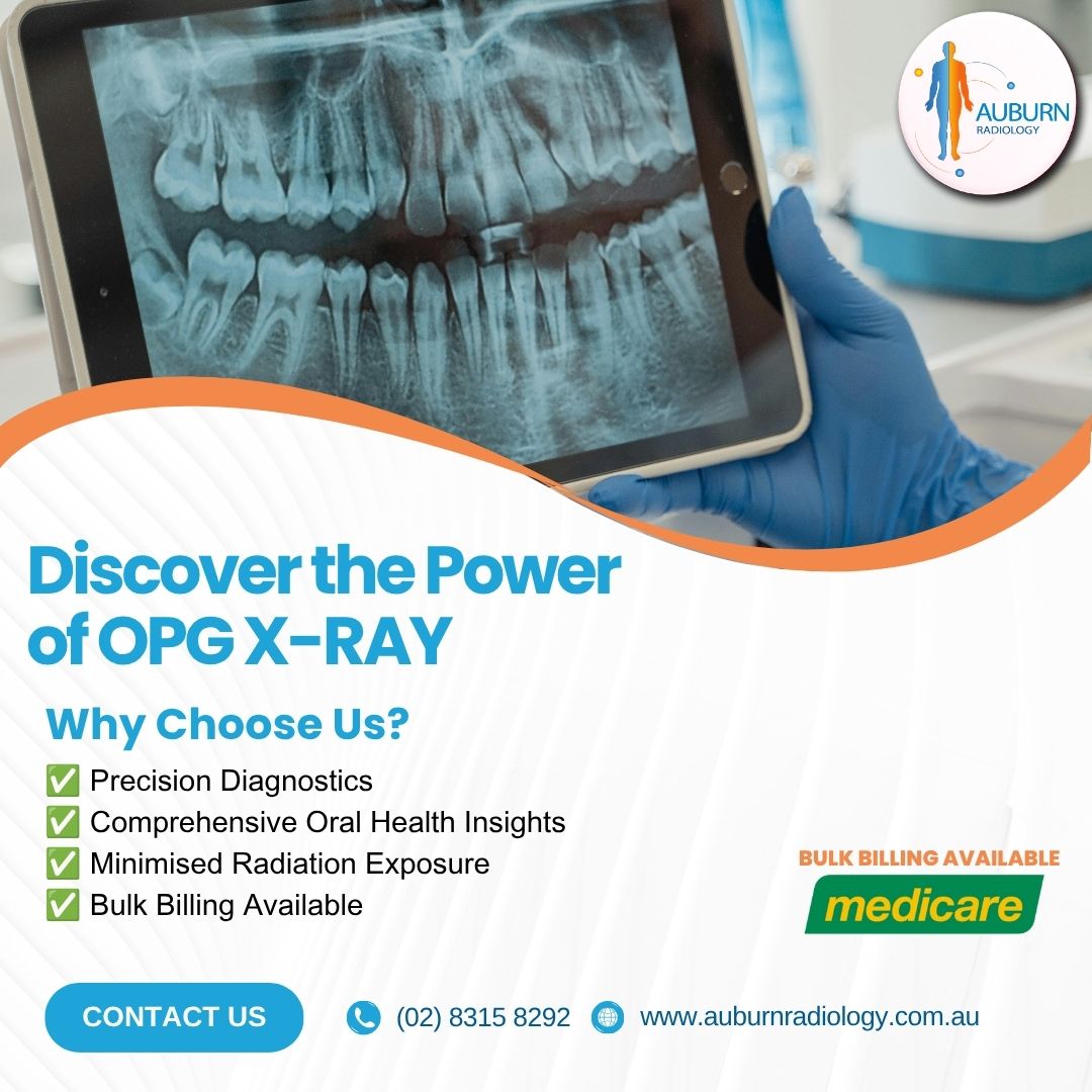  Discover the Power of OPG X-Ray at Auburn Radiology! (02) 8315 8292