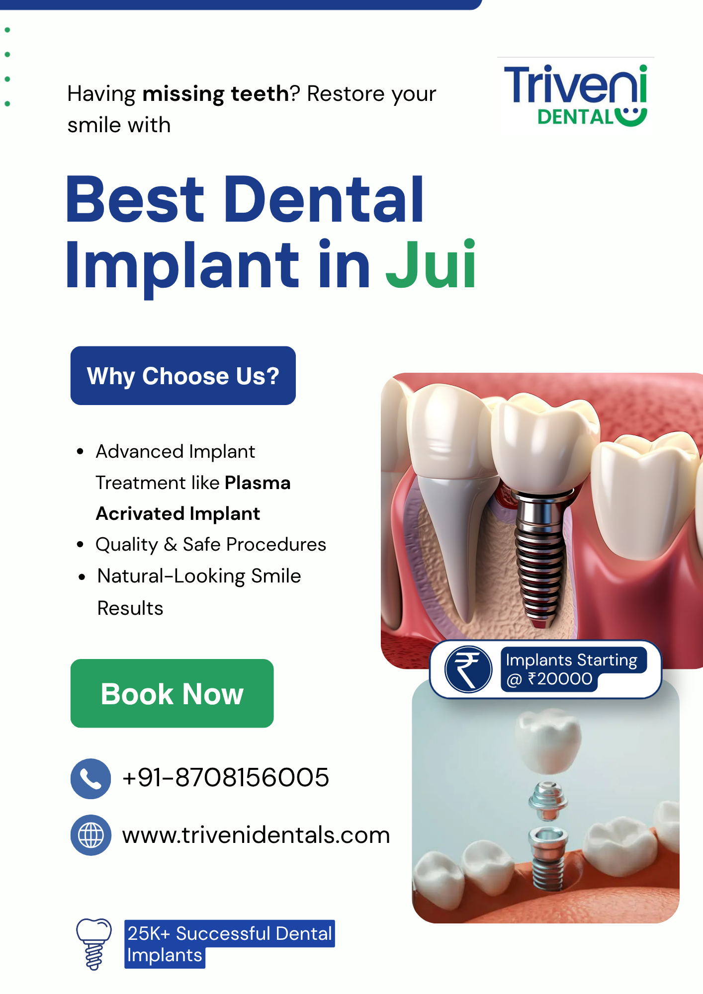  Dental Implants in Jui | Triveni Dental
