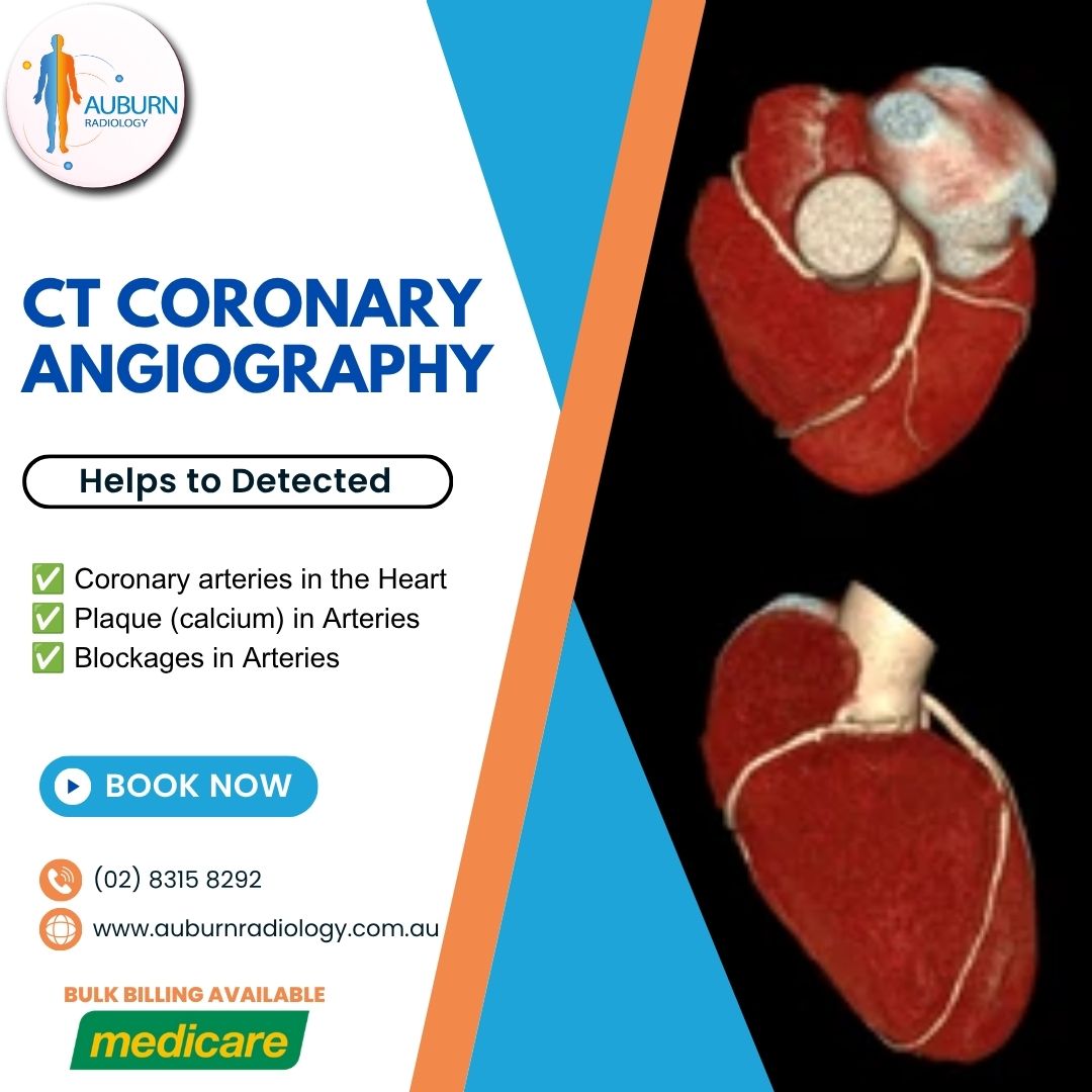  CT Coronary Angiography at Auburn Radiology. (02) 8315 8292