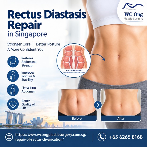  Book a Consultation for Rectus Diastasis Repair in Singapore