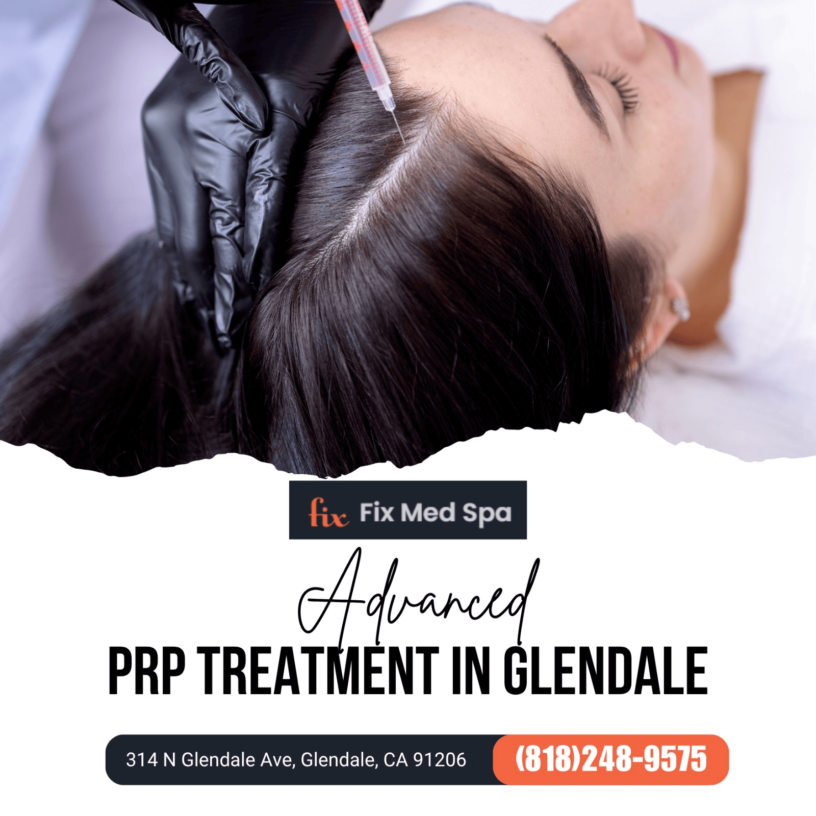  Advanced PRP Treatment in Glendale