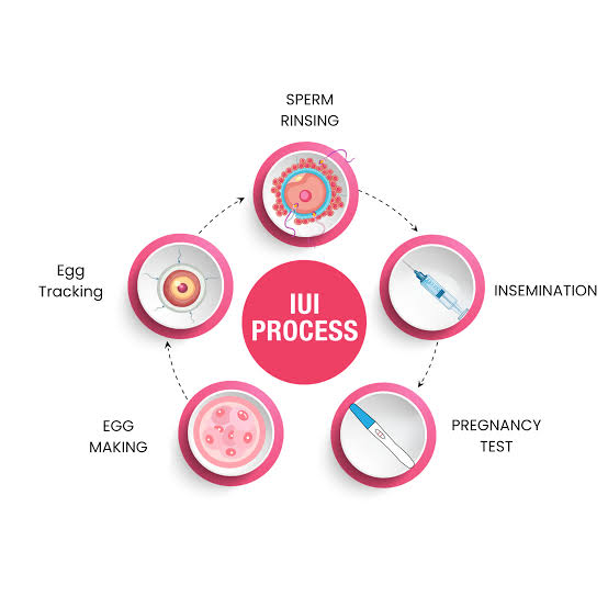  IUI Success Rate: Chances of Pregnancy by Age & Cycle