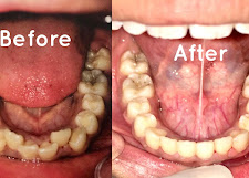  Choose Trusted Root Canal Treatment in Mahanagar for Damaged Teeth