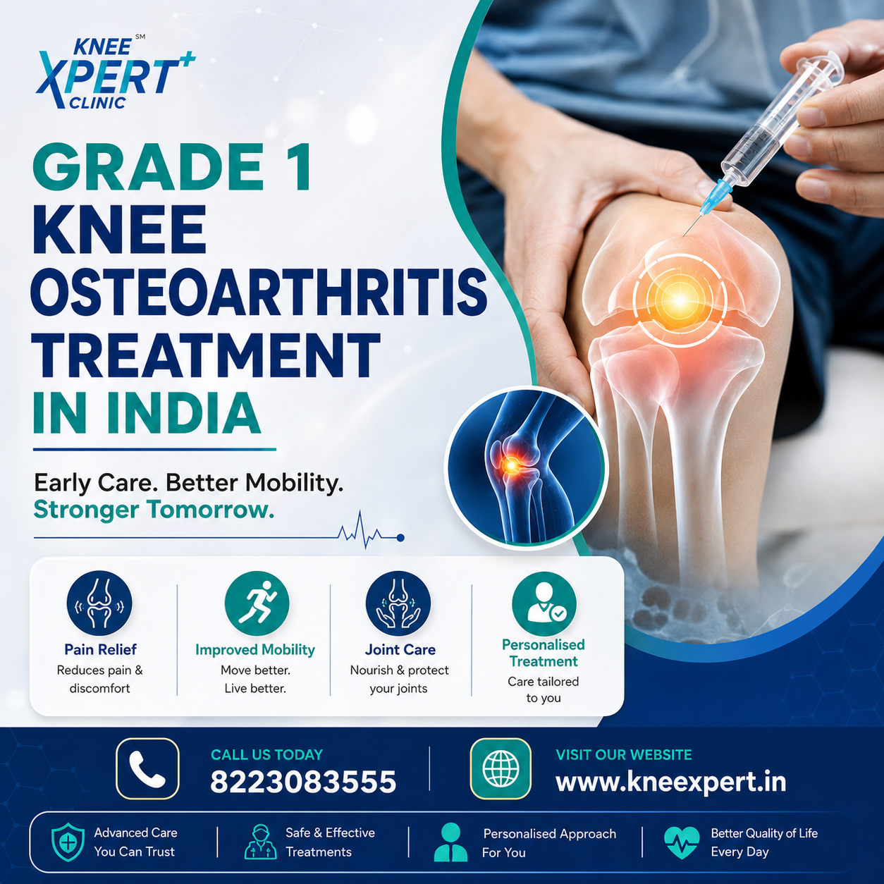 Grade 1 Knee Osteoarthritis Treatment in India - KneeXpert