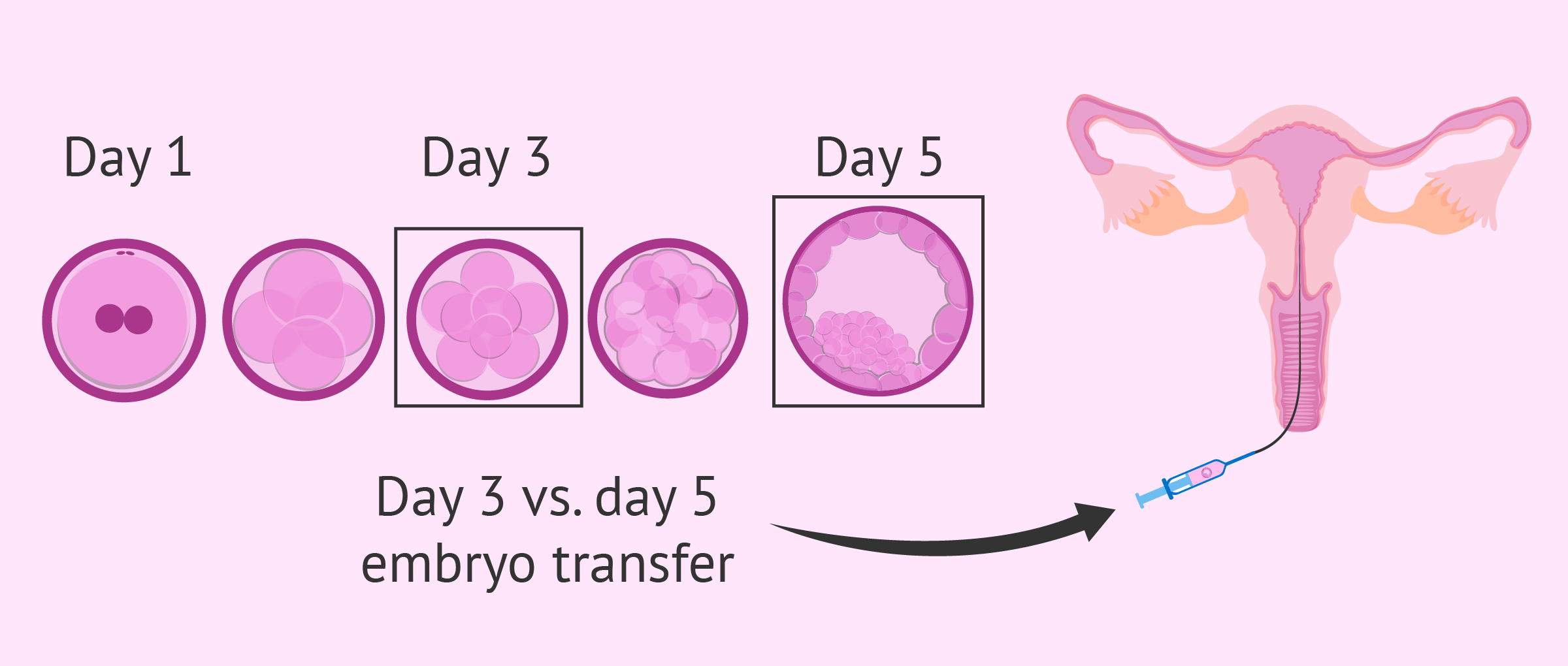  Blastocyst vs Day 3 Embryo Transfer: Success Rate & Cost