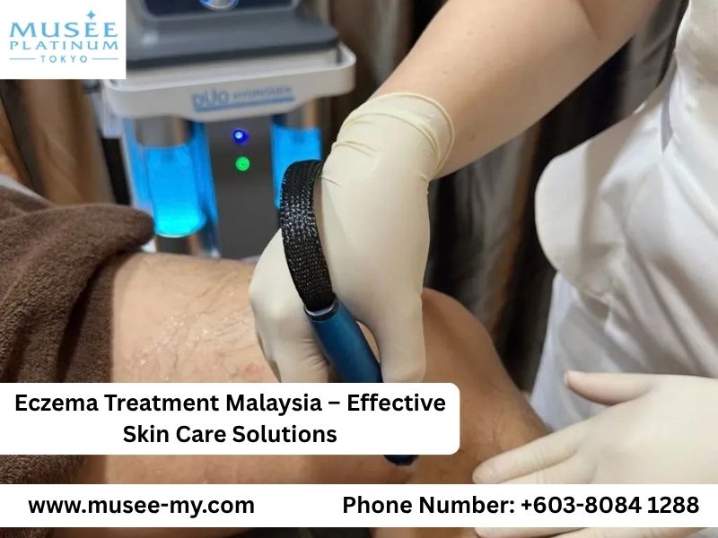  Eczema Treatment Malaysia – Effective Skin Care Solutions