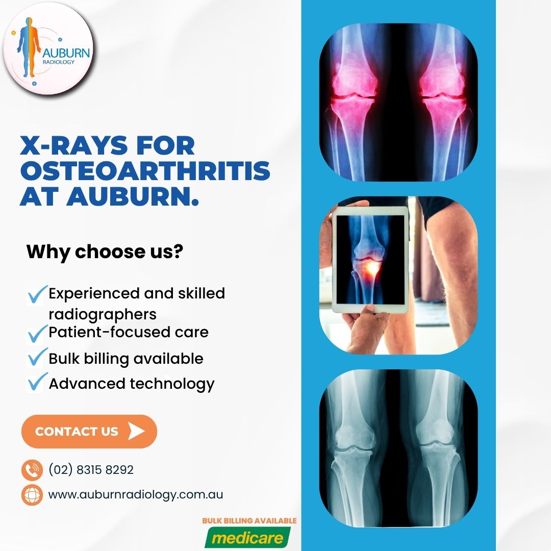  X-rays for Osteoarthritis at Auburn Radiology. (02) 8315 8292