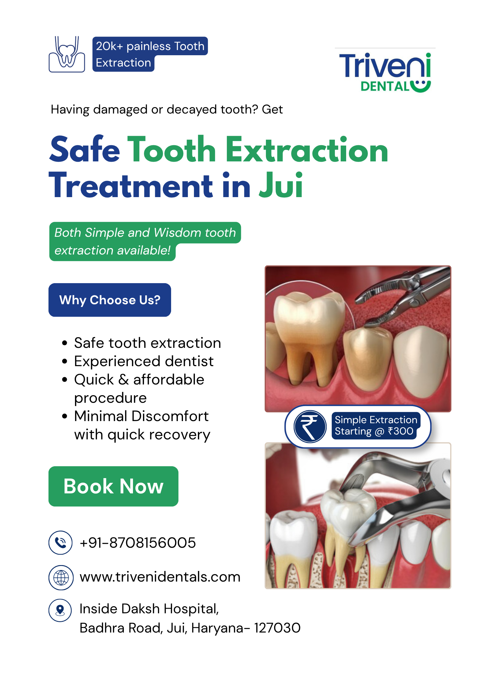  Tooth Extraction Treatment in Jui | Triveni Dental