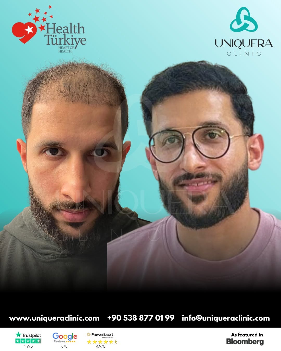  UniquEra Clinic – Hair Transplant Clinic in Istanbul, Turkey