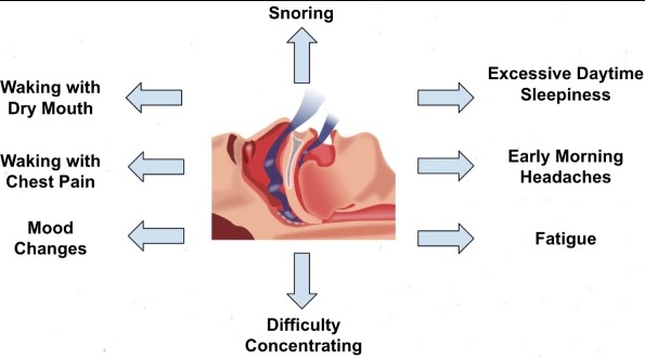  Snoring & Sleep Apnea Specialist in Kota, Rajasthan – Dr. Sheetu Singh