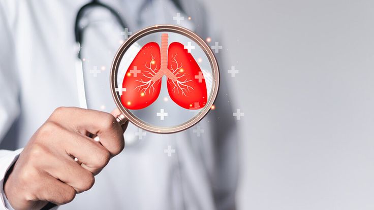  Homeopathic Doctors For Lung Cancer