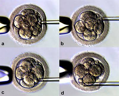 Assisted Embryo Hatching: Zona Pellucida Hatching Explained