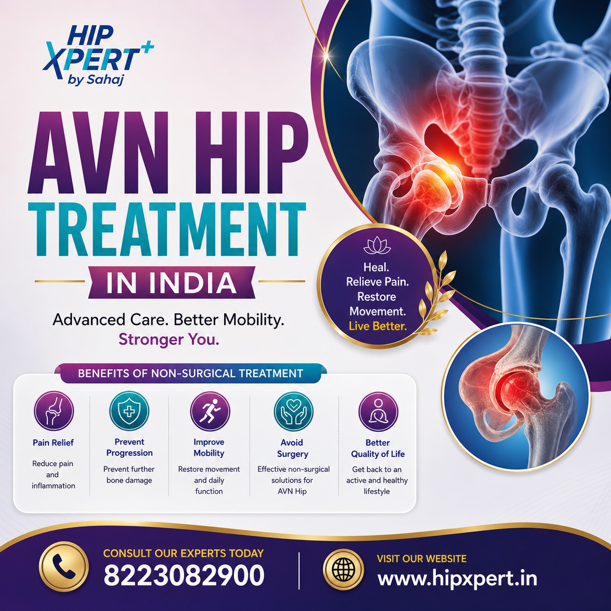  AVN Hip Treatment in India - HipXpert