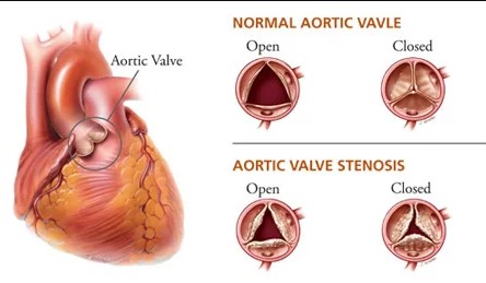  Heart Specialist for Angioplasty & Cardiovascular Care in Jaipur, Rajasthan | Dr. Ravinder Singh Rao