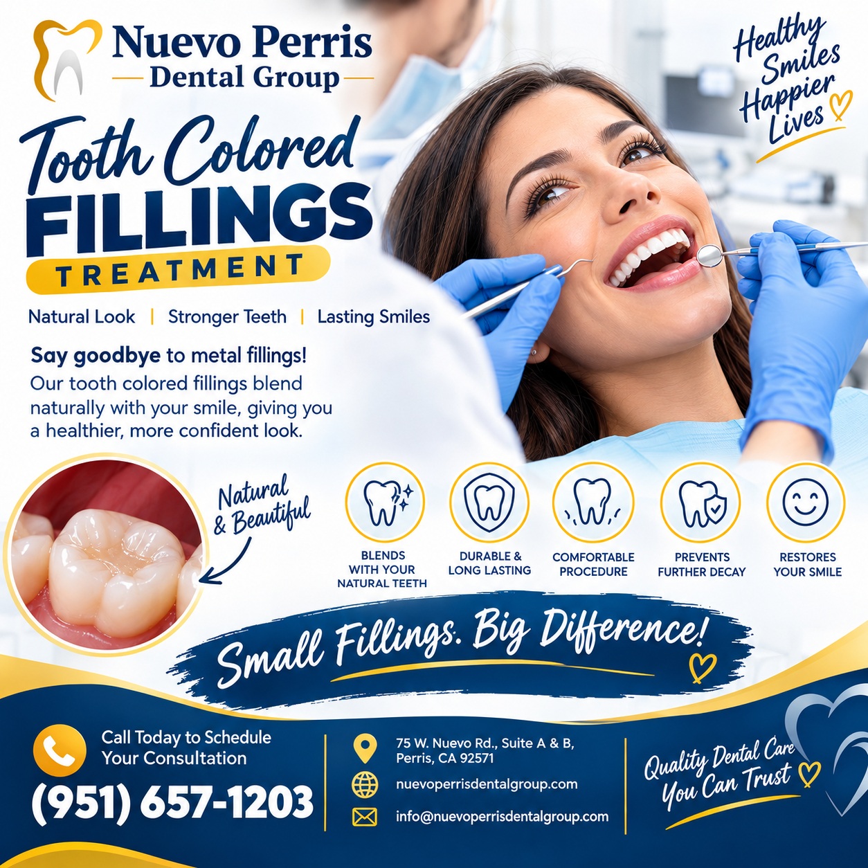  Natural-Looking Tooth Colored Fillings in Homeland - Dr. Tejas Modi