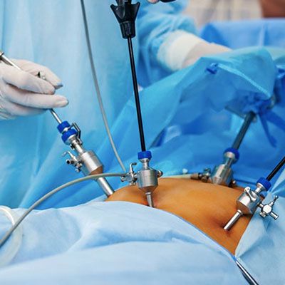  Laparoscopic Oncologist Surgeons