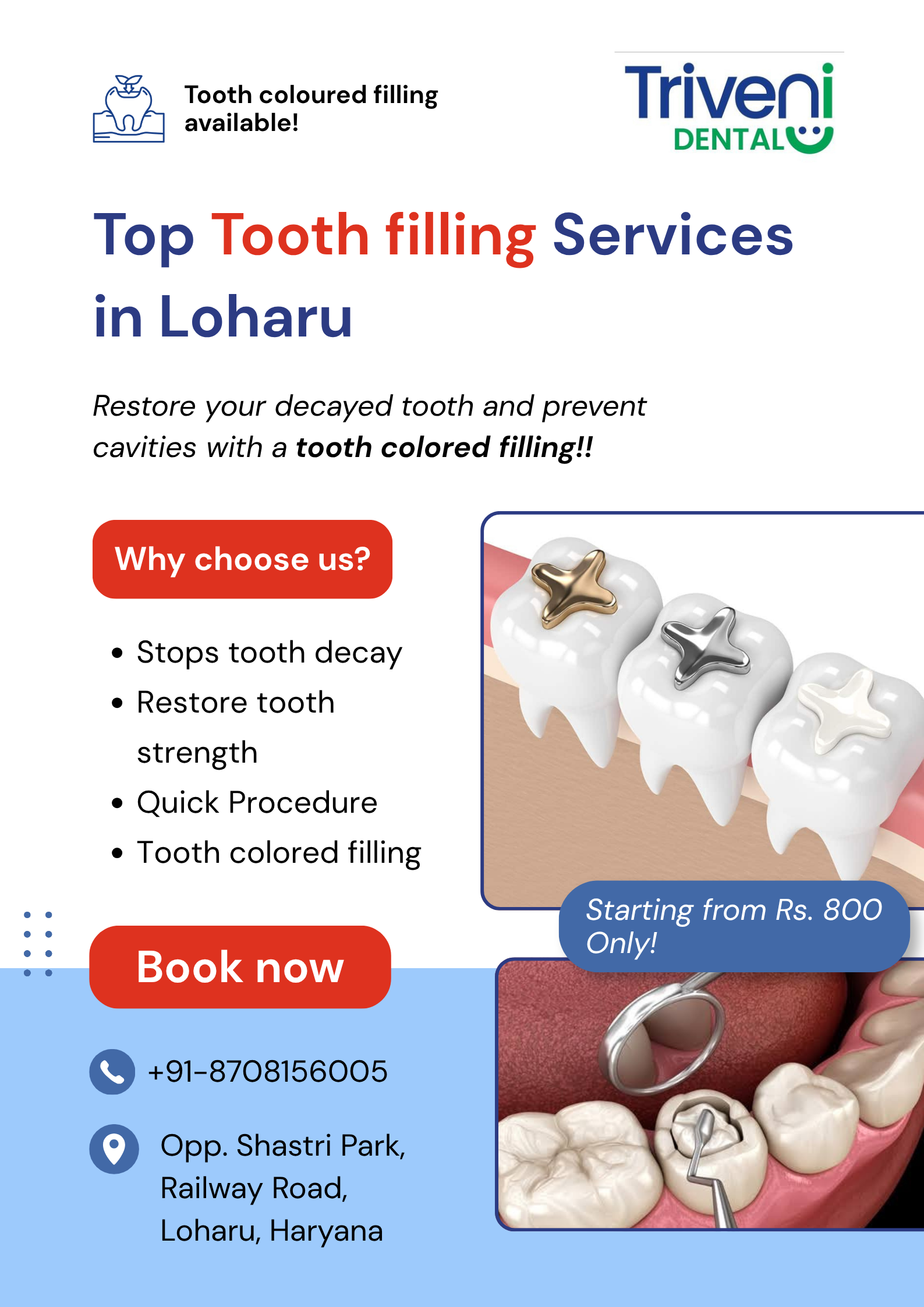  Tooth Filling Services in Loharu | Triveni Dental