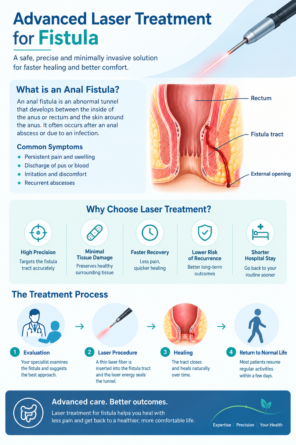  Advanced Laser Treatment for Fistula | Dr.Parthasarathy