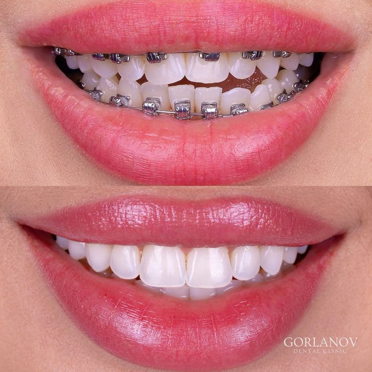  Trusted Orthodontic Services And Sedation Dentistry Somerset for Better Smiles