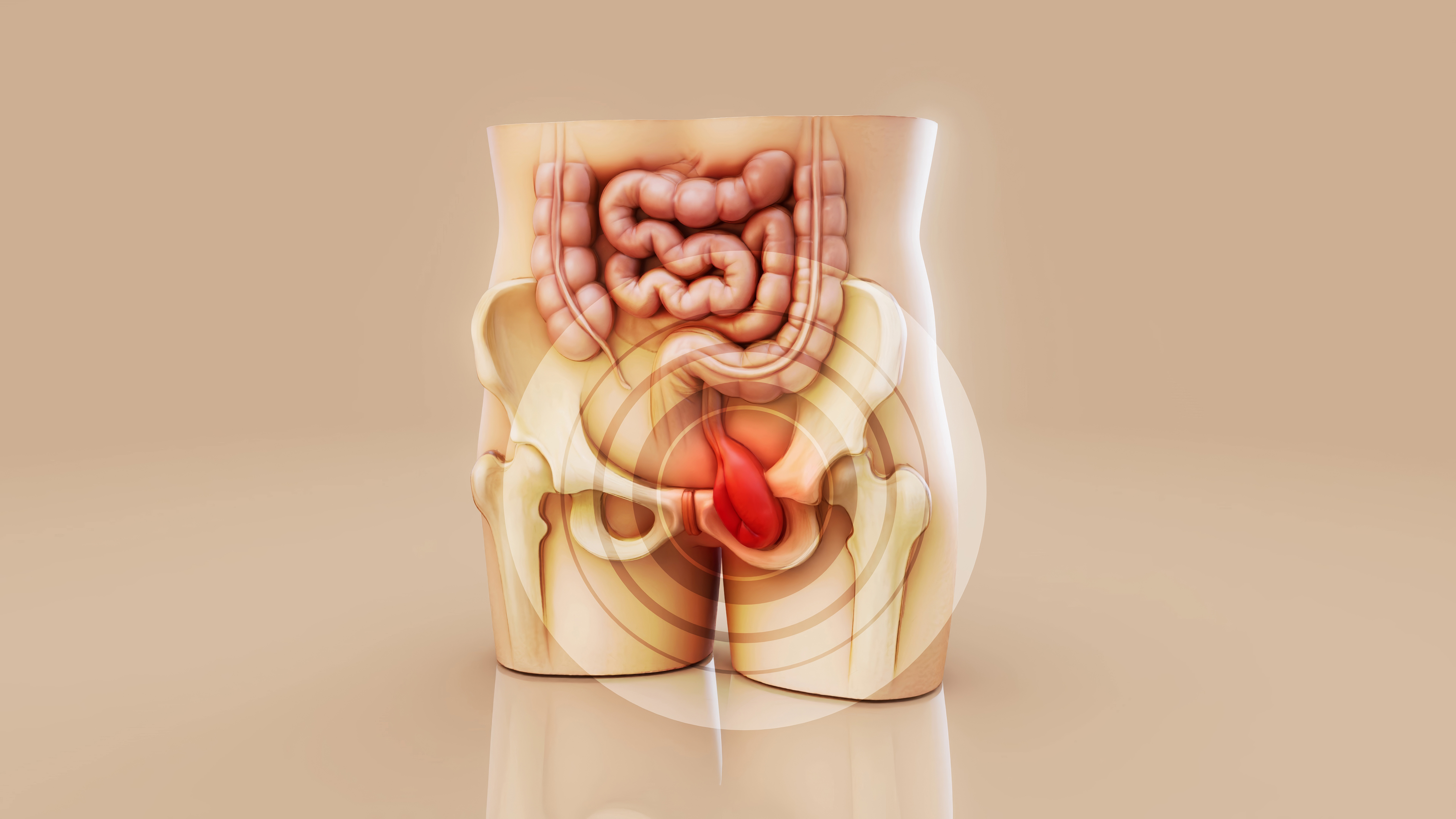  Inguinal Hernia Surgery in Hyderabad