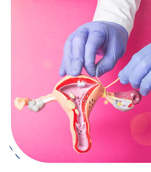  Tubal Ligation: Procedure, Cost & Recovery | Wonder Wombs